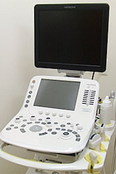 超音波診断装置(ARIETTA 60)